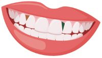 Teeth graphic.